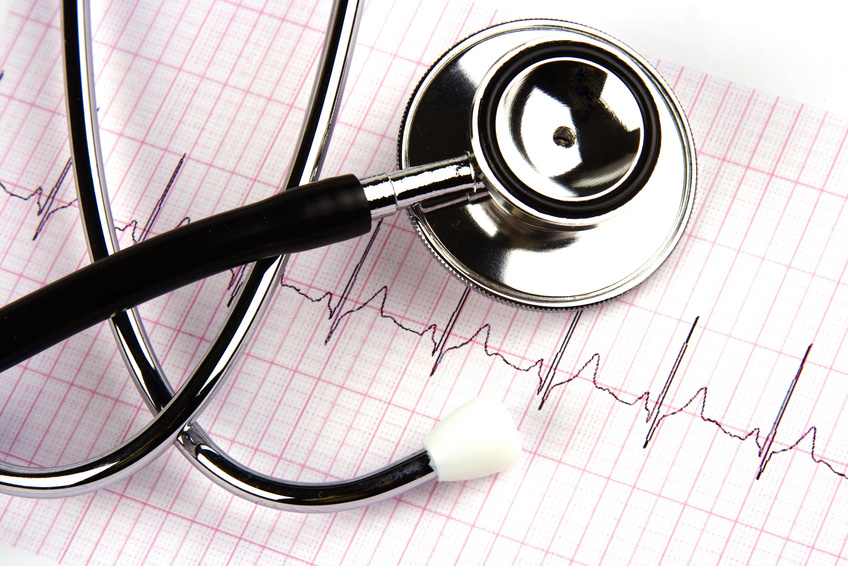 A stethoscope over a electrocardiogram close up.